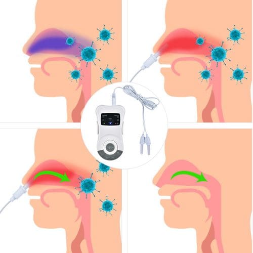 Aparelho Bionase Laser Tratamento para Rinite e Sinusite